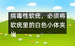 病毒性軟疣，必須將軟疣里的白色小體夾出